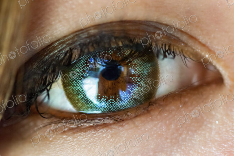 A close up of a human eye, with a content lens in place. A reflection of an object or…
