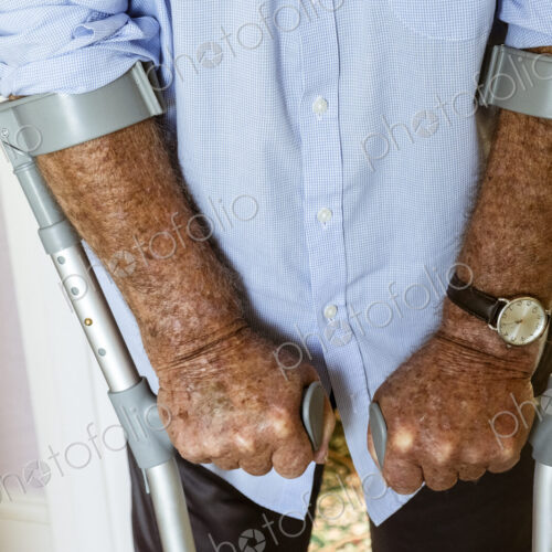 A man using crutches, with his weathered hands on the handles.