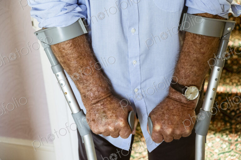 A man using crutches, with his weathered hands on the handles.