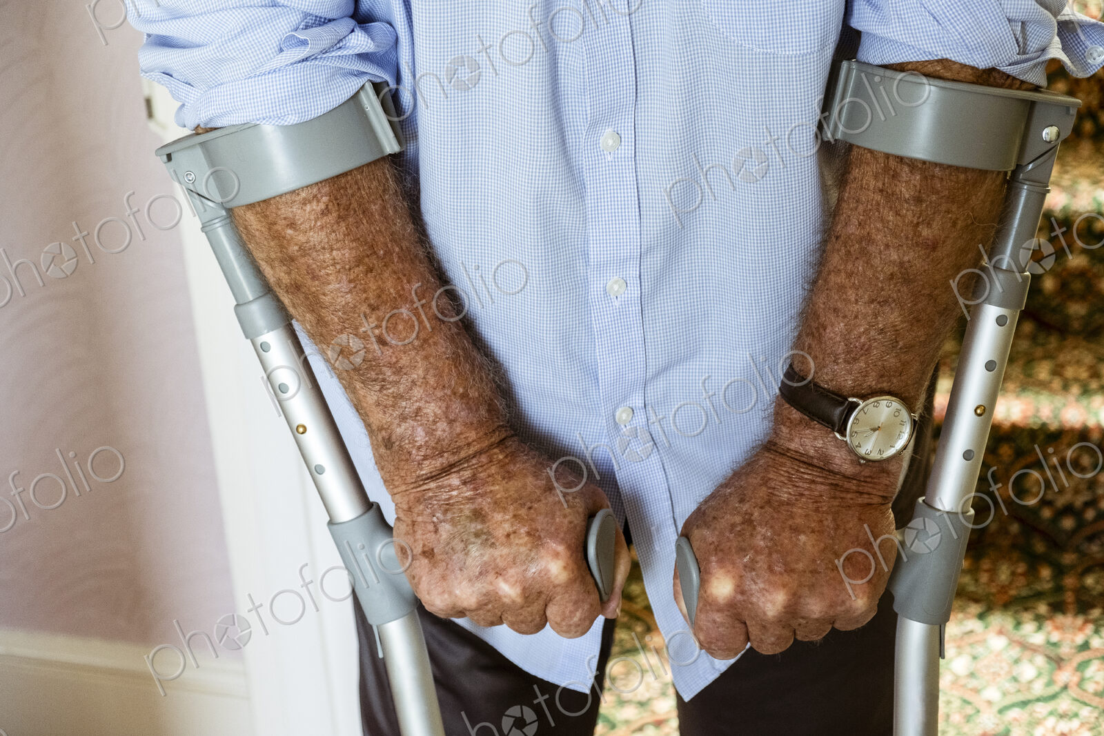 A man using crutches, with his weathered hands on the handles.