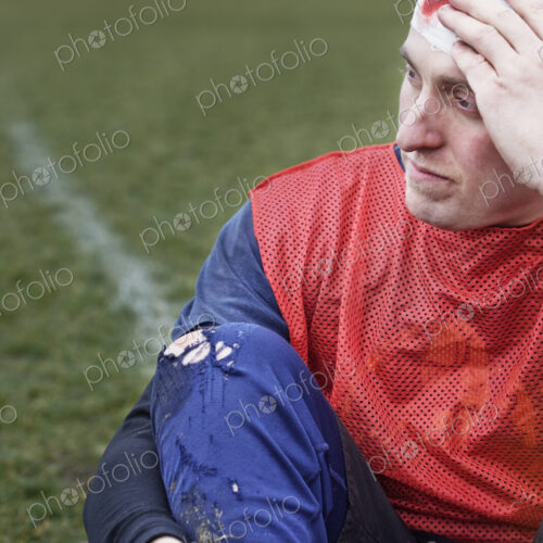 Caucasian man who has a head injury in a sporting event. Caucasian man who has a head injury in a sporting event.