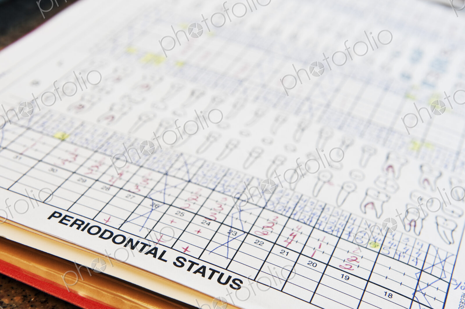Closeup of dental records for a typical patient.