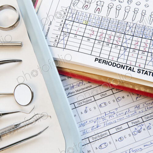 Closeup of dental tools and dental records in a dental office. Closeup of dental tools and dental records in a dental office.