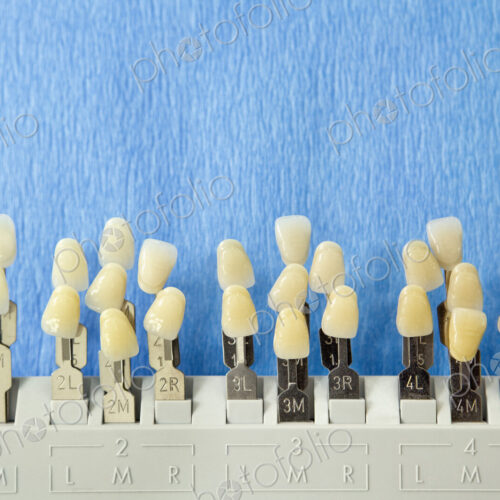 Tooth Samples