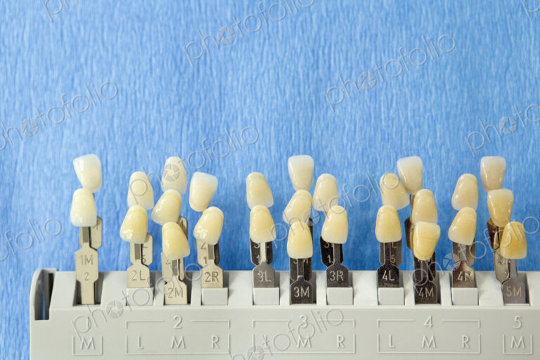 Tooth Samples